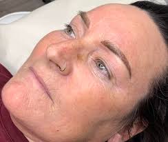 Spotted Earl Shilton & Barwell