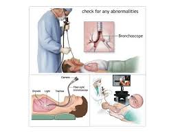 What are the benefits of a bronchoscopy? What Is Bronchoscopy Bronchoscopyis A Procedure Used To Look Inside The Lungs Airways Called The Bronchi And Bronchioles The Airways Carry Air From The Trachea To The Lungs During The Procedure Your
