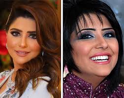 شمس الكويتية قبل عمليات التجميل. ØµÙˆØ± Ø§Ù„Ù†Ø¬Ù…Ø§Øª Ø§Ù„Ø®Ù„ÙŠØ¬ÙŠØ§Øª Ù‚Ø¨Ù„ ÙˆØ¨Ø¹Ø¯ Ø¹Ù…Ù„ÙŠØ§Øª Ø§Ù„ØªØ¬Ù…ÙŠÙ„