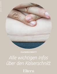 Meist wird der geplante kaiserschnitt ein bis zwei wochen vor dem errechneten termin angesetzt. Alle Wichtigen Infos Uber Den Kaiserschnitt Kaiserschnitt Schnittchen Kaiser