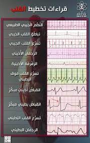 مال ذي تعنيه الأشكال المختلفة للخطوط التي نشاهدها على جهاز تخطيط القلب medical facts health and fitness expo health fitness food