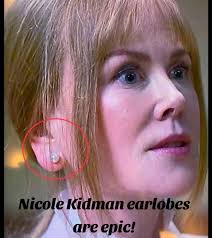 Nicole Kidman Ears