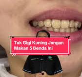 Jangan Makan 5 Benda Ini Supaya Gigi Anda Tak Kuning | TikTok