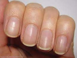 nagelpflege nagelhaut entfernen und pflegen nagelpflege nagellack ideen nagelhautentferner