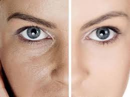 как сузить поры на лице в домашних условиях видео Pory Na Lice I Na Nosu Kak Rasparit Ochistit Rasshirit I Suzit Pory V Domashnih Usloviyah Sovety Recepty Masok Skrabov Salonnye Procedury Domashnyaya Krioterapiya Dlya Suzheniya Por Opisanie Sovety