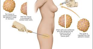 Pin On Plastic And Reconstructive Surgery Blogs