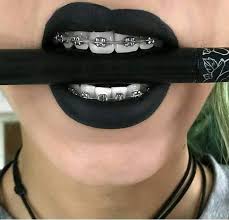 Black And White Braces Color Pin By Tall On I Black Cute Braces Braces Colors Black Braces