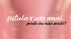 Quem tem fístula pode fazer sexo anal? | Dr. Marcelo Werneck - YouTube