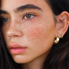 Image result for Freckled skin