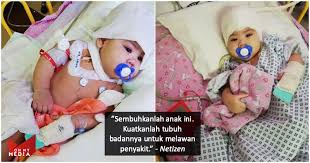 Tanda yang hadir ketika tubuh diserang jangkitan campak adalah hidung berair atau batuk, mirip seperti gejala. Sawan Tarik Demam Kuat Bayi Kecil Mangsa Terbaru Wabak Influenza A