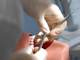 The biggest limitation is the annual maximum. Dentistry Heidelberg University
