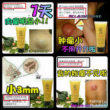 肉瘤 血瘤 粉瘤 水瘤老招牌 sensebio草本精油神仙霜改善血粘度通血管順暢血液療效百病 prolabsense 誠意招代理批發零售 kl蕉賴區可安排面交