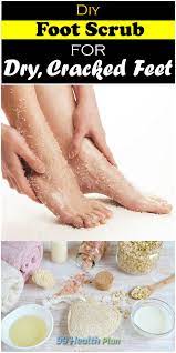 Diy Foot Scrub For Dry Cracked Feet This Amazing Diy Foot Scrub Is Very Simple And Easy To Perform And You Ll Want Diy Foot Scrub Cracked Feet Diy Foot Soak