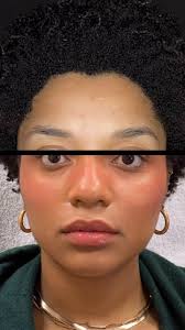 Filler 👏🏽 Facial 👏🏽 Balancing, Filler can be used to provide such  beautiful highlight and contours to the face!!! And the Botox I put in her  masseters is the chef’s kiss 😘., Got Q’s? Drop them below!, ...