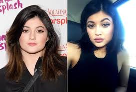 Celebs In Denial About Their Plastic Surgery At Just 17 Years Old Kylie Has Made Ne Bad Celebrity Plastic Surgery Kylie Jenner Plastic Surgery Lip Injections
