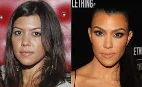 But sudden changes in their looks and body structure couldn't keep their secrets for much longer. The Kardashians Insane Transformations In Pictures