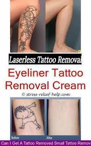 Tattoo Laser Behandlung Wie Man Emla Creme Zur Tattooentfernung Verwendet Die Laserlose Behan Tattoo Removal Tattoo Removal Cost Tattoo Removal Results