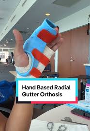 Image result for Radial Gutter Cast