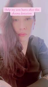 Vein Swelling During Plasma Donation