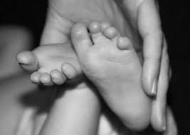 Clubfoot is a common disorder in which one or both of a baby's feet are turned inward and downward and can't easily be moved into a normal position. Clubfoot Born With A Turned Foot Podiatry Associates P C