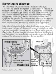 Diverticulosis And Diverticulitis Infographic Health Diverticulitis Diverticulitis Diet