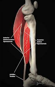 As nouns the difference between gastrocnemius and soleus. Not The Plantaris Keys To Better Diagnosis Of Calf Strain Injuries Radsource