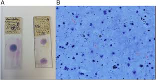 Obtain a demineralized compact bone preparation (in cross section), preferably from the diaphysis of a long bone, and prepare to examine it microscopically. A Two Of The Giemsa Stained Slides Analyzed In This Study Labeled Cm Download Scientific Diagram