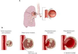 Image result for Pseudoeriosema