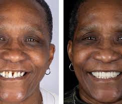 Regaining Confidence Through Digital Dentistry