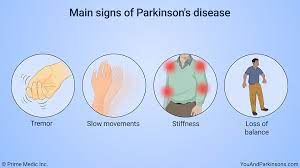 Parkinson matratze jetzt über die thevocalm informieren, anti dekubitus system kci first step plus wechseldruck, matratze für pflegebett auf rezept, thomashilfen schlaf therapie für geist körper thevo. Parkinson Matratze Test