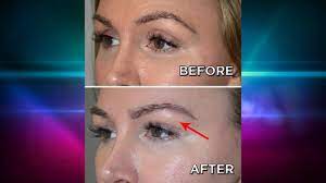 Having a strong sexual energy accomplishes a number of different things; The Doctors New Surgery To Get Trendy Bedroom Eyes Facebook