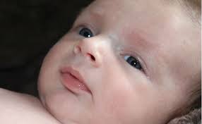 Bebeklerde Beyaz Leke Bebek Bebek Kis Yeni Dogan Bebekler
