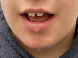 نتیجه جستجوی لغت [drooling] در گوگل
