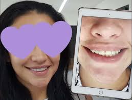 C.D. Jose Ortegón Xeque