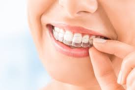Every smile is unique and every treatment journey is different, so the cost of invisalign depends on your needs. Invisalign Grand Blanc Mi Invisible Braces Michigan Dental Wellness