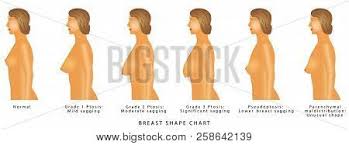 breast shape chart vector photo free trial bigstock