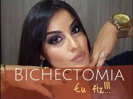 Um rosto mais fino, a ausência de bochechas. Eu Fiz Bichectomia Imagens Antes Durante E Depois Youtube