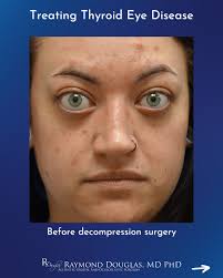 Dr. Raymond Douglas, Reconstructive & Aesthetic Oculoplastic Specialist