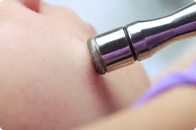 Wie unsere erfahrung und die meinung von experten aus der kosmetikbranche gezeigt haben, würden wir von eins bis zwei anwendungen im monat raten. Mikrodermabrasion Kosten Risiken Behandlung Mooci