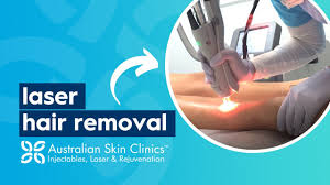 Australian laser & skin clinics in melbourne trust the leading laser clinics in australia for medical grade laser hair removal, advanced skin treatments and cosmetic treatments, with multiple skin care clinics located all across melbourne servicing residents from the cbd to the outer suburbs. Laser Hair Removal From 9 Australian Skin Clinics