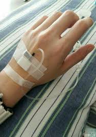 30 Gambar Tangan Perempuan Lagi Di Infus Terlengkap Riwayat Gallery