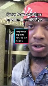 Jul 26, 2021 · fetty wap is strikingly different to other rappers, not only because of his voice but also due to his physical appearance. Entdecke Beliebte Videos Von Fetty Wap Eye Tiktok