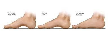Maybe you would like to learn more about one of these? The Best Running Shoes To Support High Arches The Running Outlet