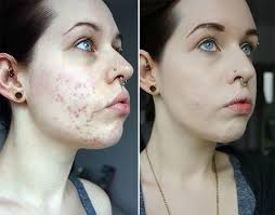 KOREAN BEAUTY RAVE REVIEW: LUNA LONG LASTING TIP CONCEALER [POSSIBLE NARS  DUPE] • Colorcrrush