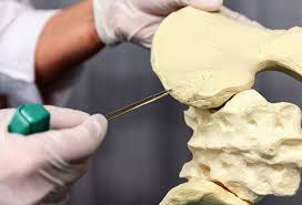 Visual Guide To Bone Cancer