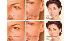 Carolina center for advanced dentistry provides general, family and cosmetic dentistry in conway. Skin Rejuvenation Laser Services Brigham And Women S Hospital