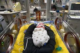 Image result for Preterm Infant