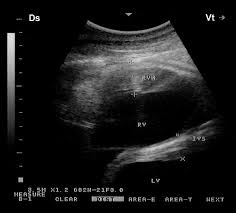 However, people may be staring at you as you walk. Echocardiography Of The Normal Camel Camelus Dromedaries Heart Technique And Cardiac Dimensions Bmc Veterinary Research Full Text