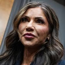 kristi noem teeth before and after pictures