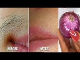 ازاله شعر الوجه وفوق الشفايف ومنع نموه بمكون فى مطبخك احصلي بشره بيضاء وصافيه Youtube Upper Lip Hair Upper Lip Hair Removal Lip Hair